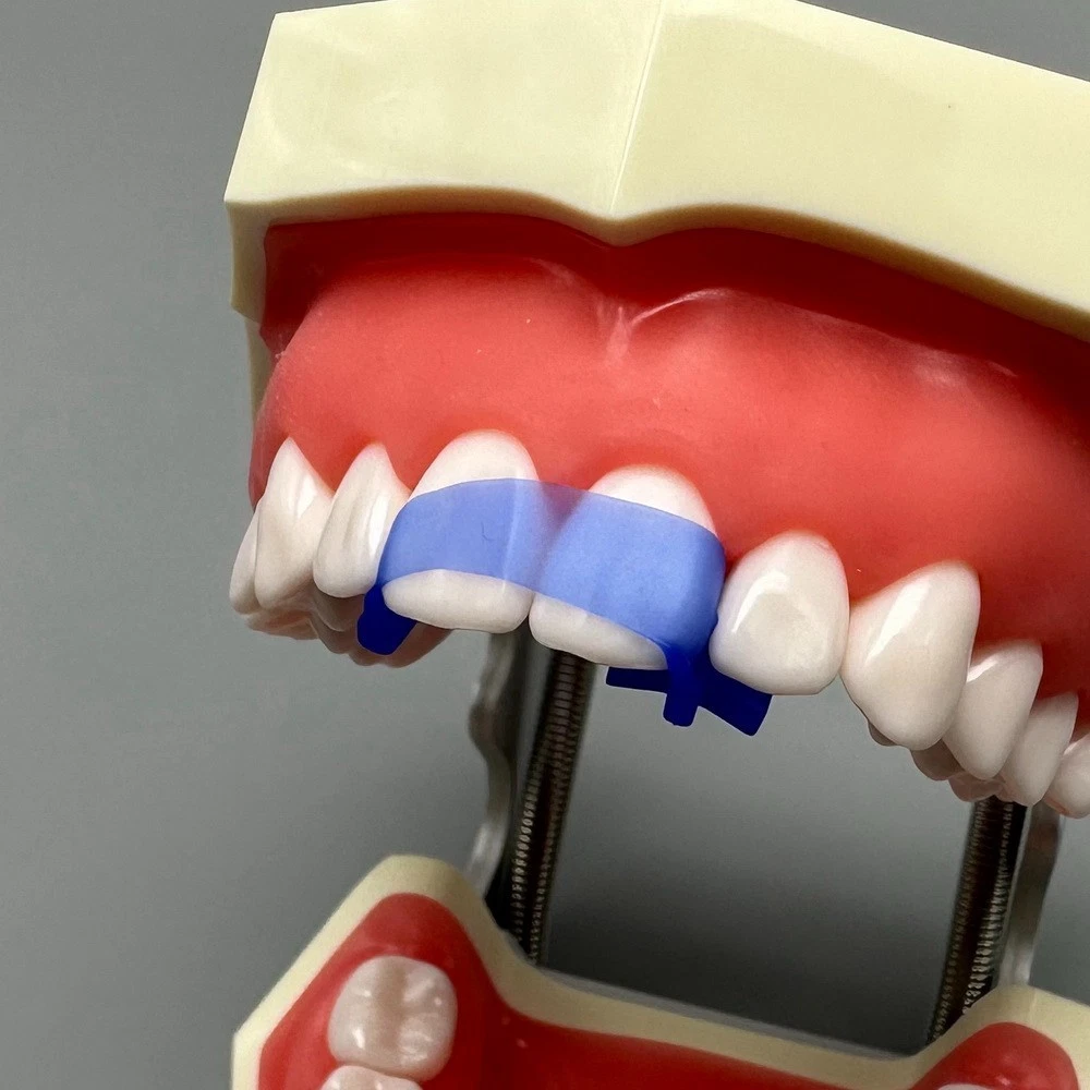 10Pcs Dental Elastic Wedges Protector All-in-one Front Anterior Teeth Matrices Wedge