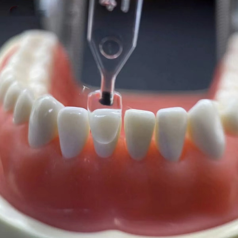 30Pcs Dental Composite Resin Veneer Moulds, Light Cure Templates for Front Anterior Teeth Restorations