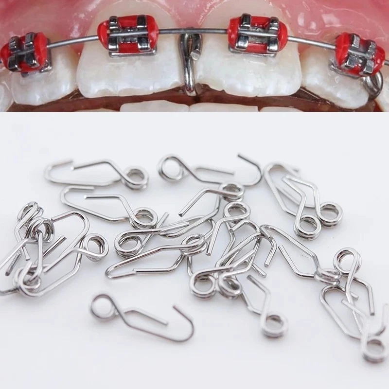 100Pcs Separating Spring Orthodontic Dental Self-Locking Separate Spring Separator