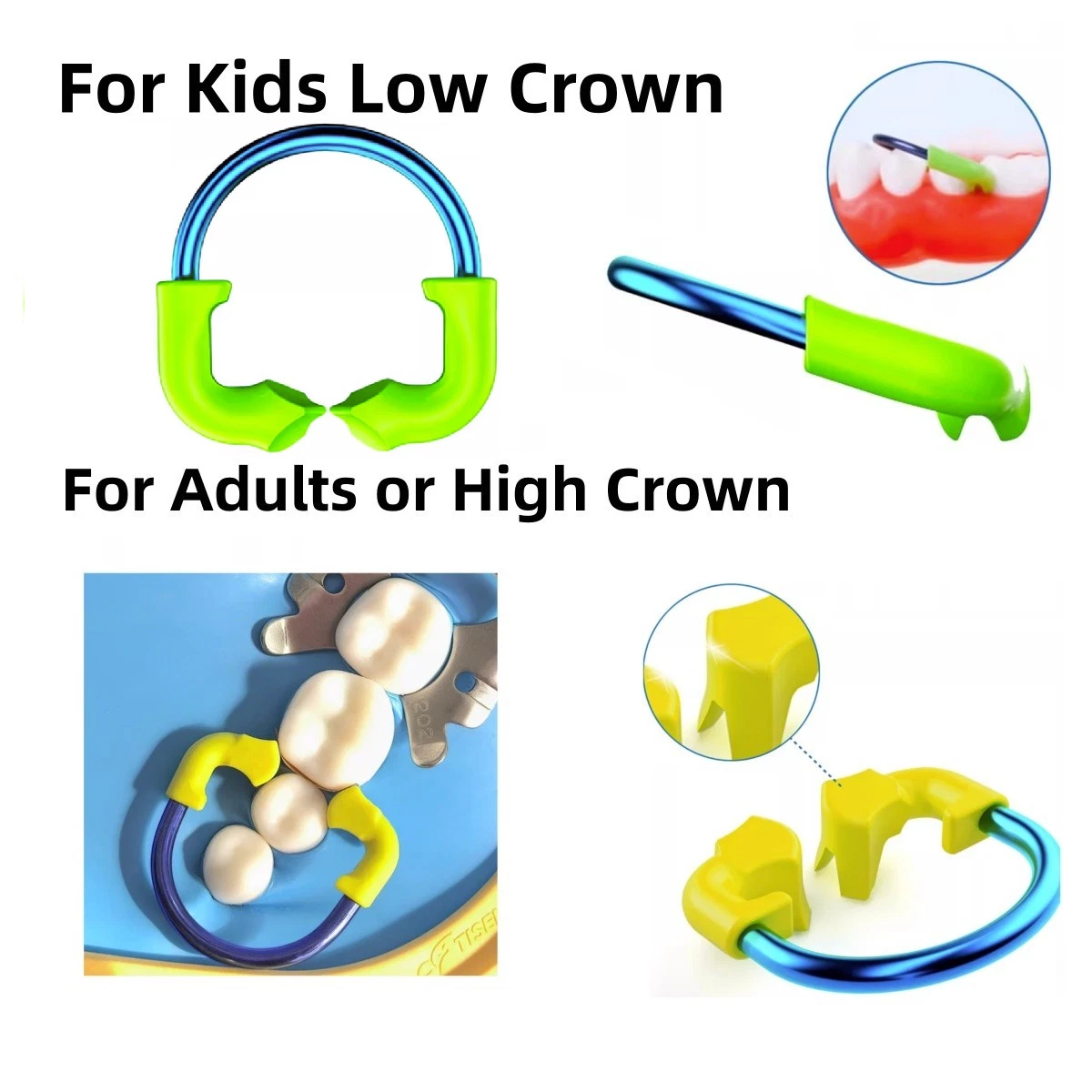 Dental Clamp Sectional Matrix Nickel Titanium Clamping Ring For Adults Kids