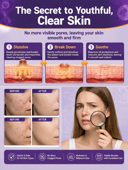 This Swiss Biotin & Peptide 10-in-1 Rejuvenating Cream deeply repairs acne-prone skin, redness, deep wrinkles, and dark spots in just 7 days, restoring firm, smooth, and youthful-looking skin.
