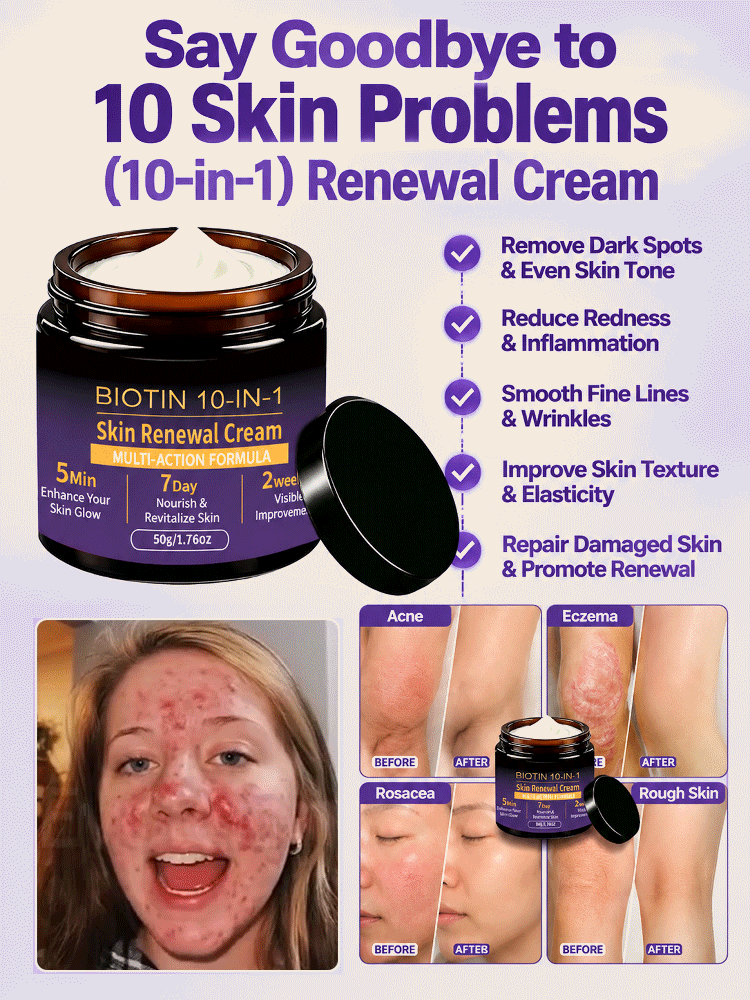 This Swiss Biotin & Peptide 10-in-1 Rejuvenating Cream deeply repairs acne-prone skin, redness, deep wrinkles, and dark spots in just 7 days, restoring firm, smooth, and youthful-looking skin.