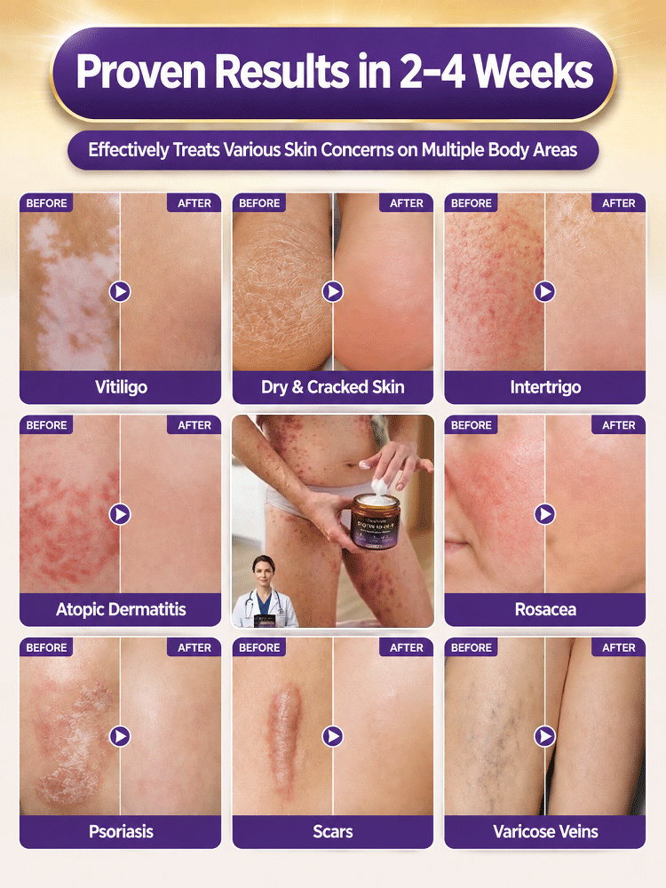 This Swiss Biotin & Peptide 10-in-1 Rejuvenating Cream deeply repairs acne-prone skin, redness, deep wrinkles, and dark spots in just 7 days, restoring firm, smooth, and youthful-looking skin.