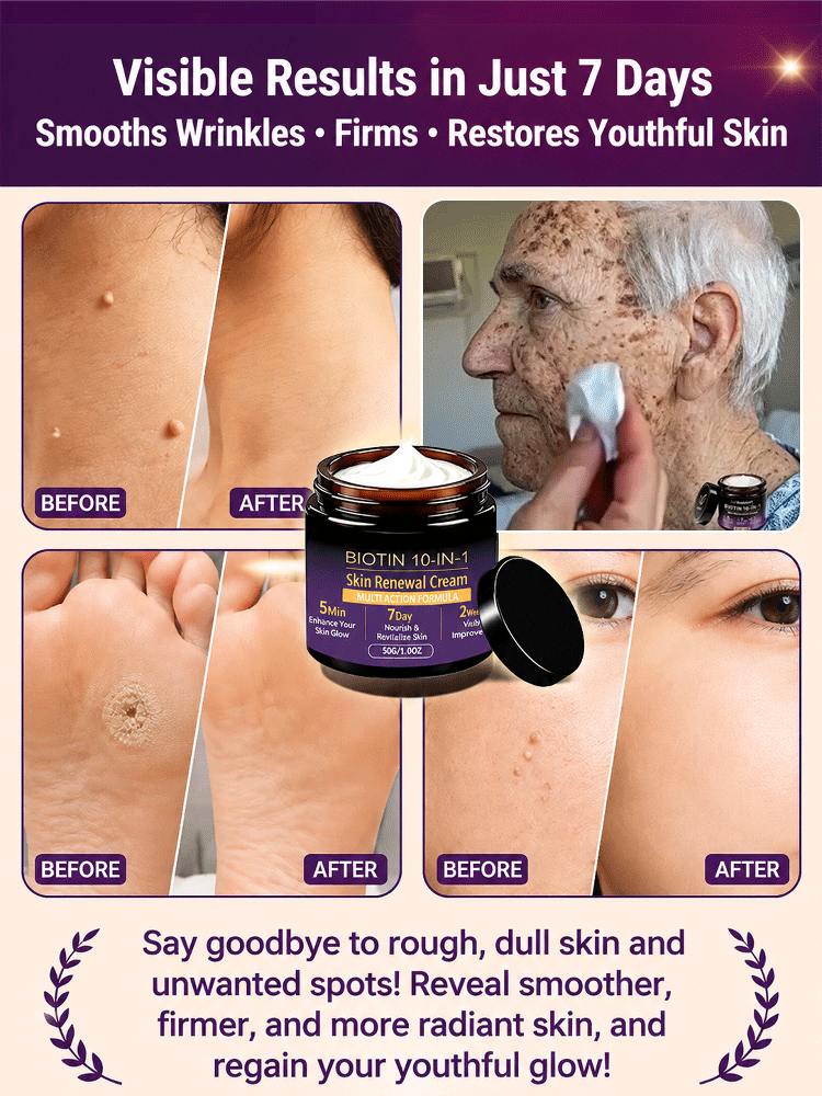 This Swiss Biotin & Peptide 10-in-1 Rejuvenating Cream deeply repairs acne-prone skin, redness, deep wrinkles, and dark spots in just 7 days, restoring firm, smooth, and youthful-looking skin.