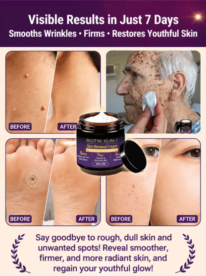 This Swiss Biotin & Peptide 10-in-1 Rejuvenating Cream deeply repairs acne-prone skin, redness, deep wrinkles, and dark spots in just 7 days, restoring firm, smooth, and youthful-looking skin.