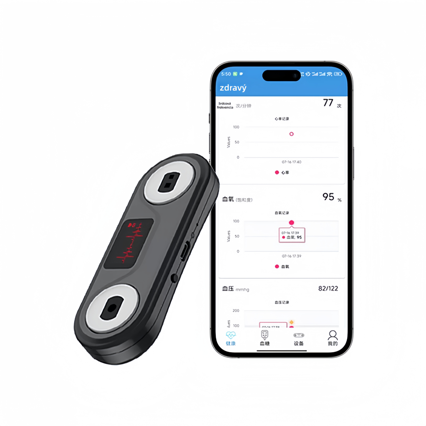 Inteligentný neinvazívny glukomer