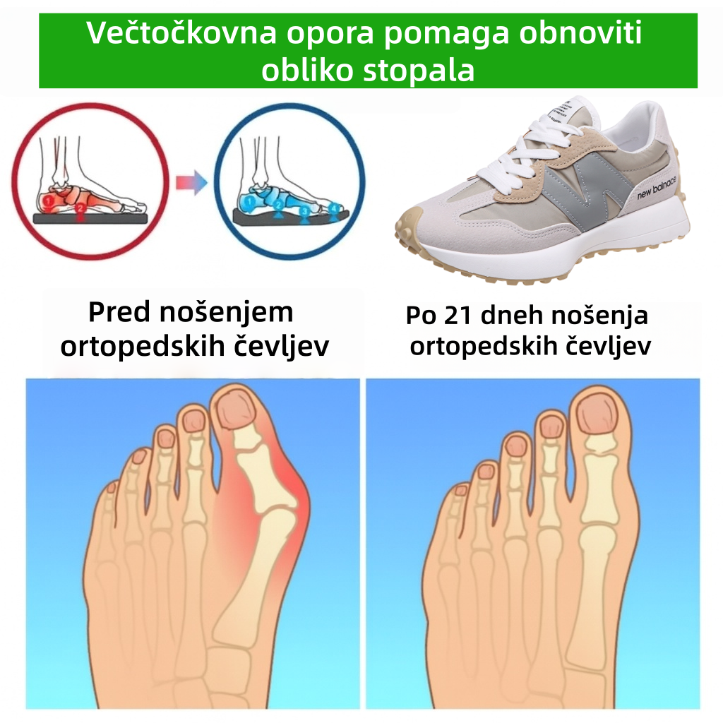 🔥50 % popust! ⏰Ergonomsko oblikovani luksuzni ortopedski čevlji za ženske✅ Mehki, udobni in z odlično oporo🦶 - Učinkovito lajšajo bolečine v stopalih