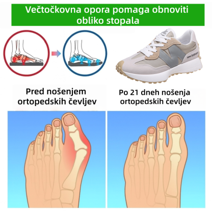 🔥50 % popust! ⏰Ergonomsko oblikovani luksuzni ortopedski čevlji za ženske✅ Mehki, udobni in z odlično oporo🦶 - Učinkovito lajšajo bolečine v stopalih