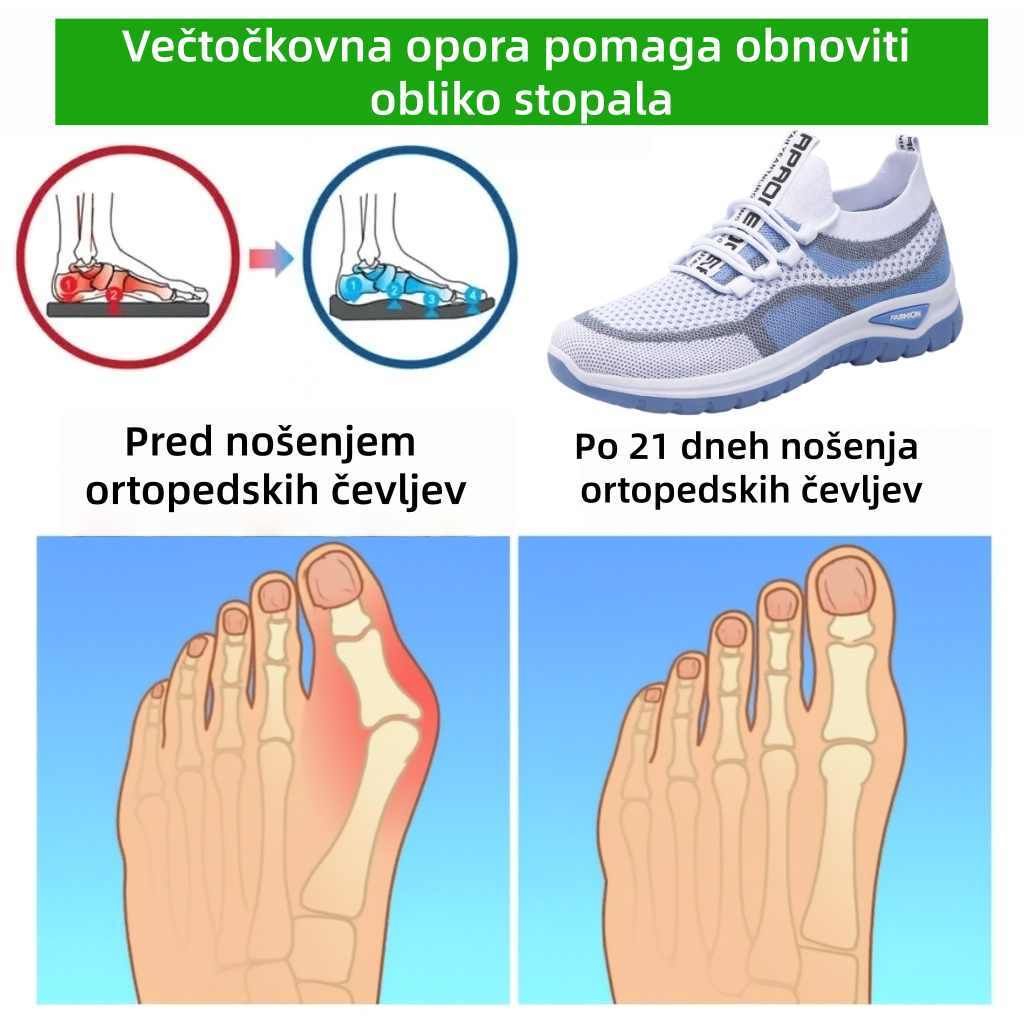 🔥70 % popusta danes - Ne zamudite! ⏰ Ergonomsko oblikovani ortopedski čevlji - zasnova za podporo stopalnega loka 👞 Preprosto lajšanje bolečin v stopalih