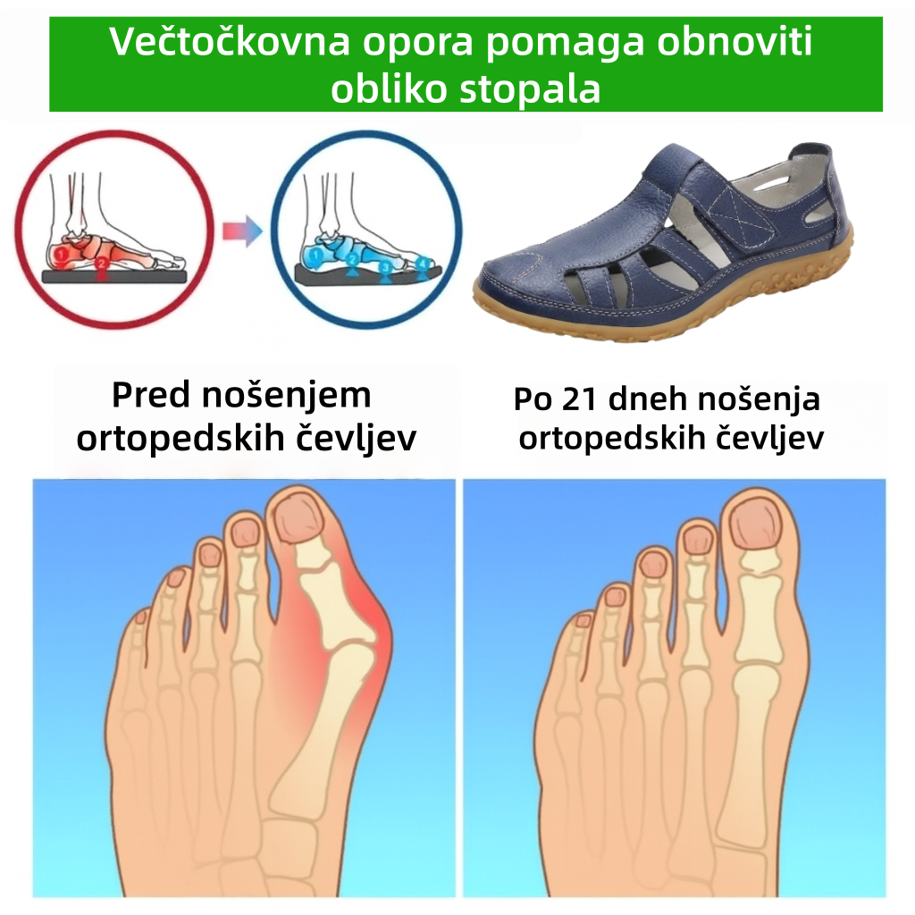 ⏰ Zadnji dan – 50 % popust! Ne zamudite!Ergonomsko oblikovani ortopedski sandali z blaženjem udarcev ✅ Zdravi ortopedski sandali, zasnovani posebej za evropske ženske