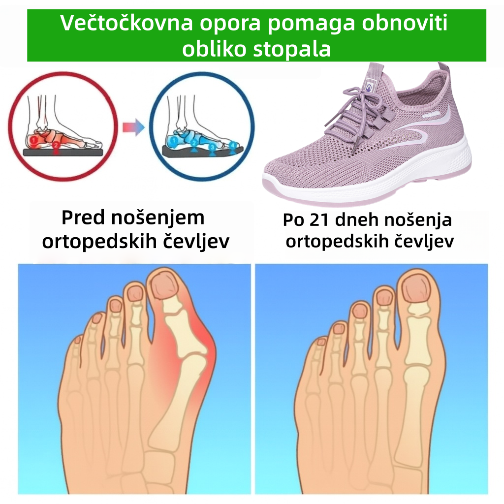 ⏰ Zadnji dan – 50 % popust! Ne zamudite! Ergonomsko oblikovani ortopedski čevlji z blaženjem udarcev. ✅ Zdravi ortopedski čevlji, zasnovani posebej za evropske ženske.