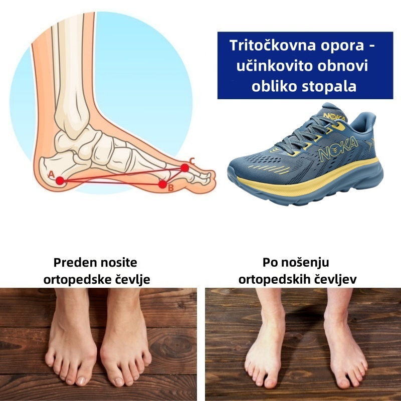 (🔥50 % popusta danes - ne zamudite!) ⏰ - znamka holious® - mehki in udobni francoski ortopedski čevlji ✅ (lajša bolečine v stopalih)