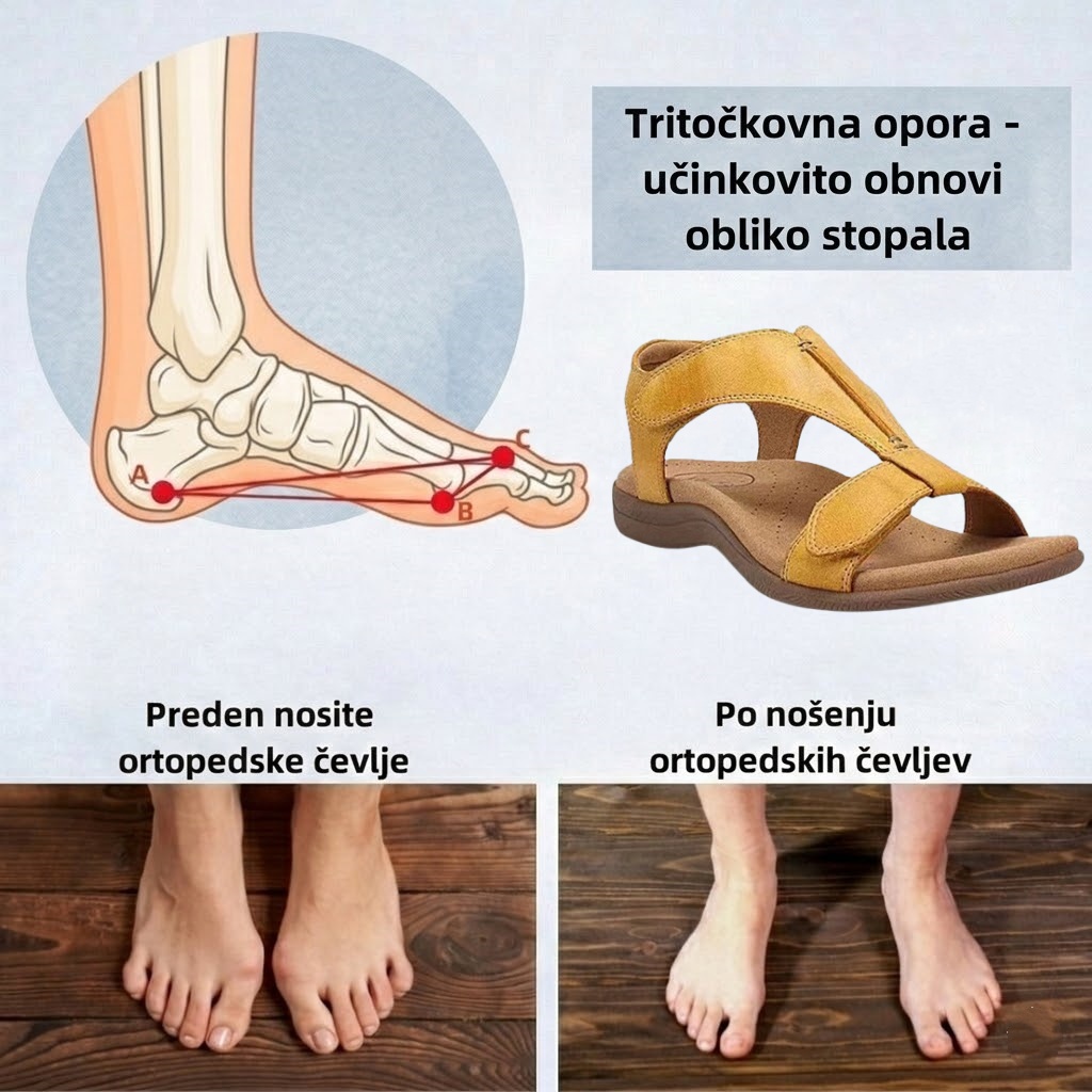 🔥Časno omejen 50 % popust! Poletni ortopedski sandali, ergonomsko oblikovani za udobje in lajšanje bolečin✅
