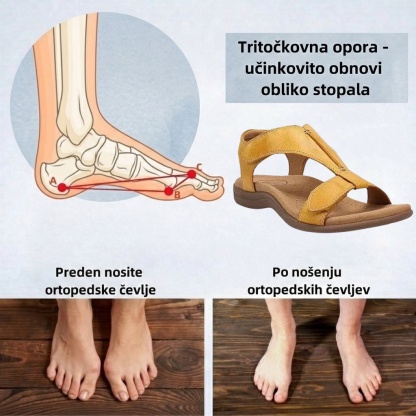 🔥Časno omejen 50 % popust! Poletni ortopedski sandali, ergonomsko oblikovani za udobje in lajšanje bolečin✅