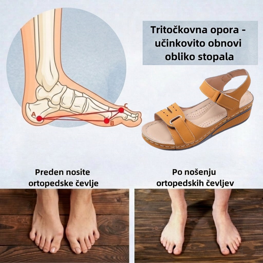 🔥Časno omejen 50 % popust! Poletni ortopedski sandali, ergonomsko oblikovani za udobje in lajšanje bolečin✅
