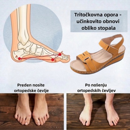 🔥Časno omejen 50 % popust! Poletni ortopedski sandali, ergonomsko oblikovani za udobje in lajšanje bolečin✅