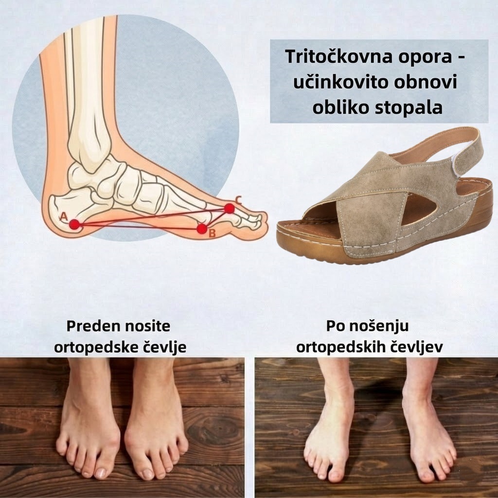 🔥Časno omejen 50 % popust! Poletni ortopedski sandali, ergonomsko oblikovani za udobje in lajšanje bolečin✅