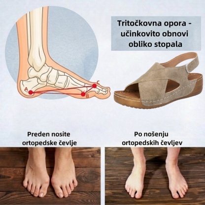 🔥Časno omejen 50 % popust! Poletni ortopedski sandali, ergonomsko oblikovani za udobje in lajšanje bolečin✅
