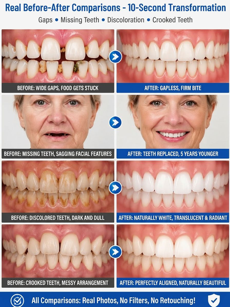 [Protect Your Perfect Smile] Fully Customized Denture Set