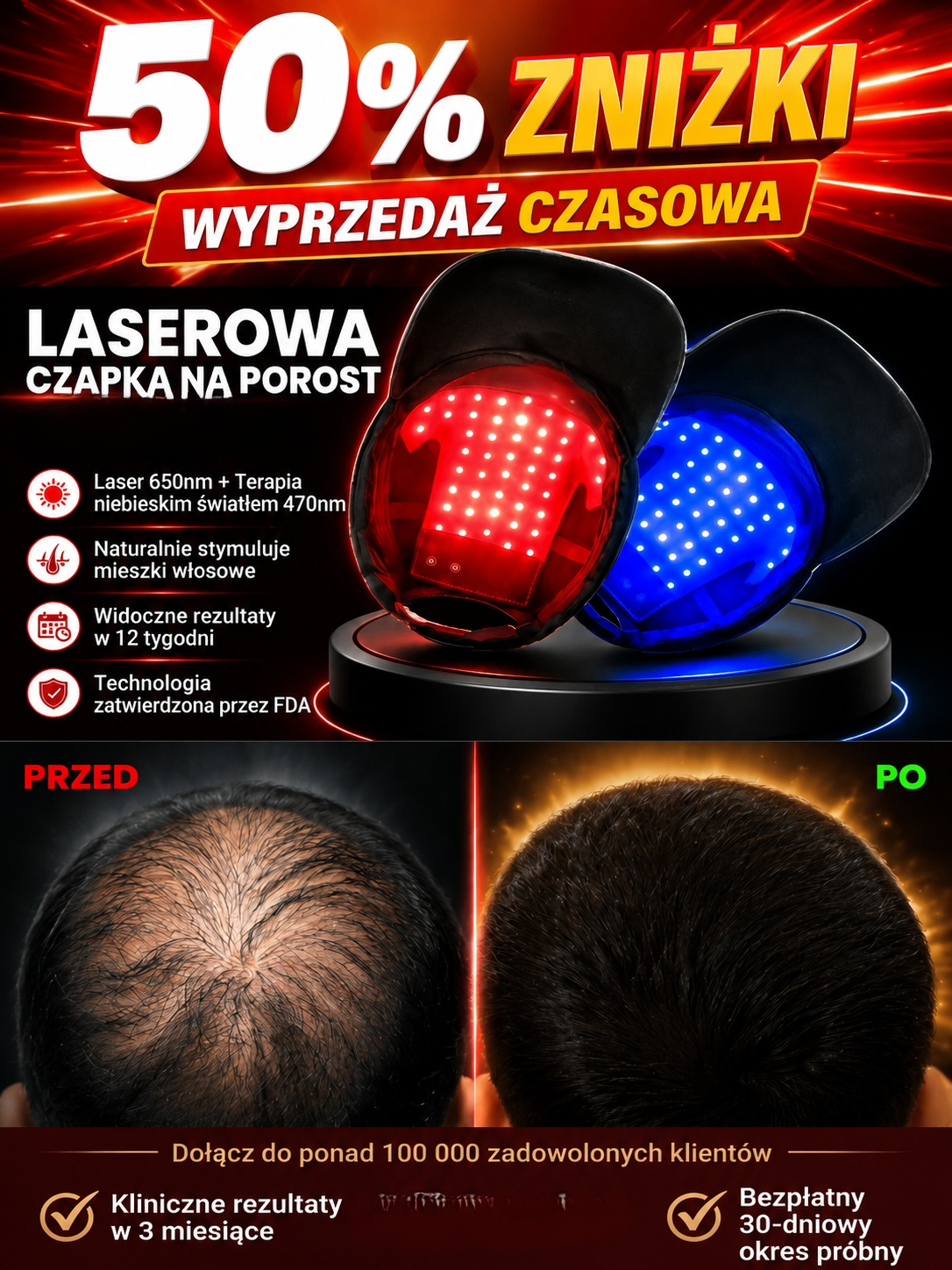 【Przeznaczone wyłącznie dla umiarkowanego i zaawansowanego wypadania włosów】Profesjonalny technologi