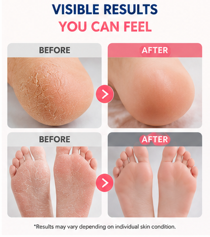 Foot Care Cream - Prevents cracking, moisturizes, nourishes, and softens.