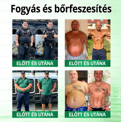 GeeLemon® Glumasetide 8 Ufficiale – Cerotto Dimagrante 3 in 1 ai Nano Microaghi