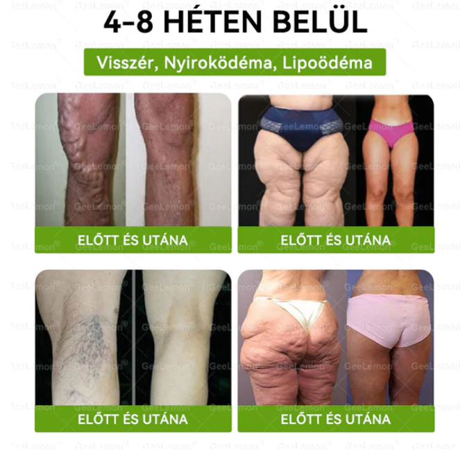 GeeLemon® Glumasetide 8 Ufficiale – Cerotto Dimagrante 3 in 1 ai Nano Microaghi