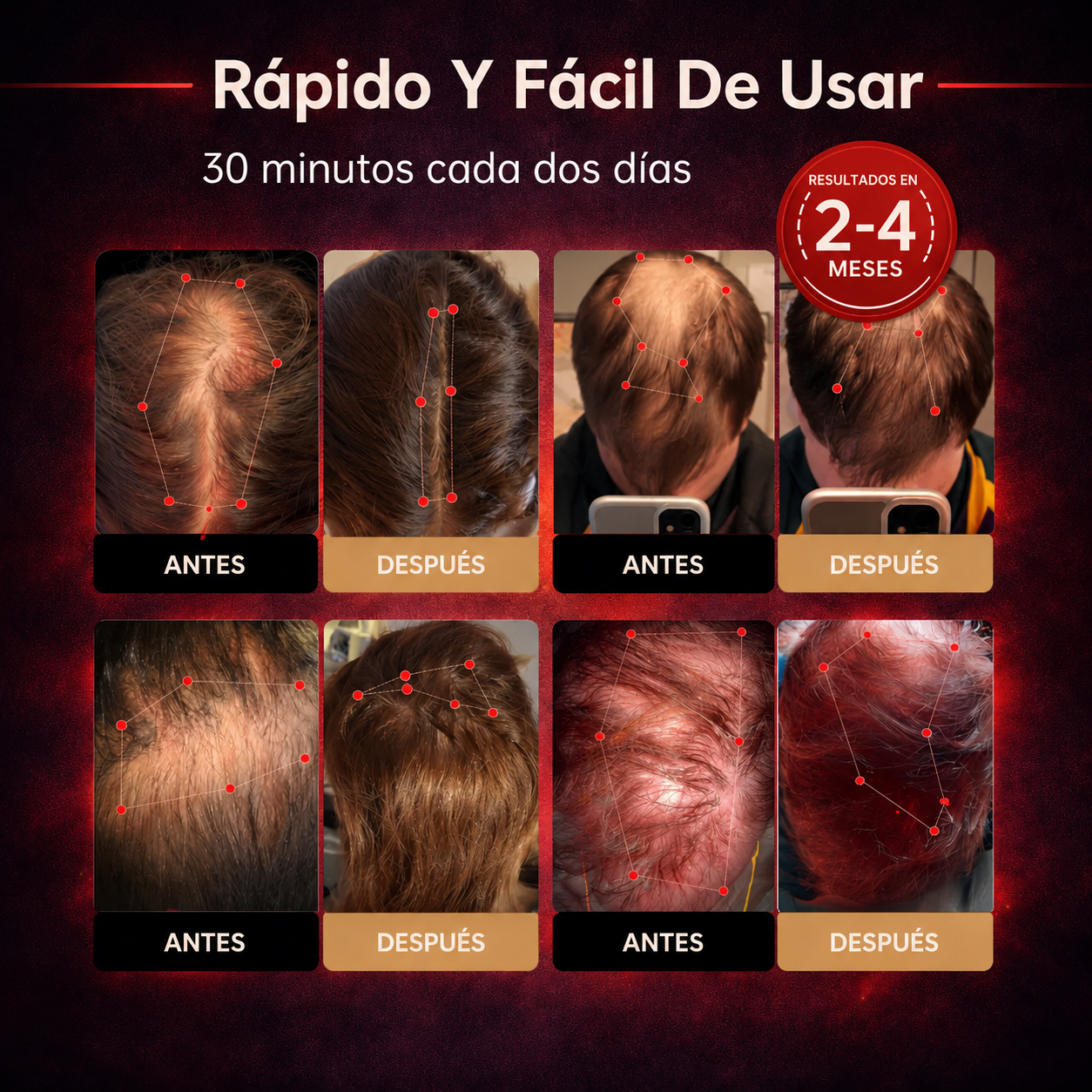 Gorro para el crecimiento del cabello con terapia de luz roja