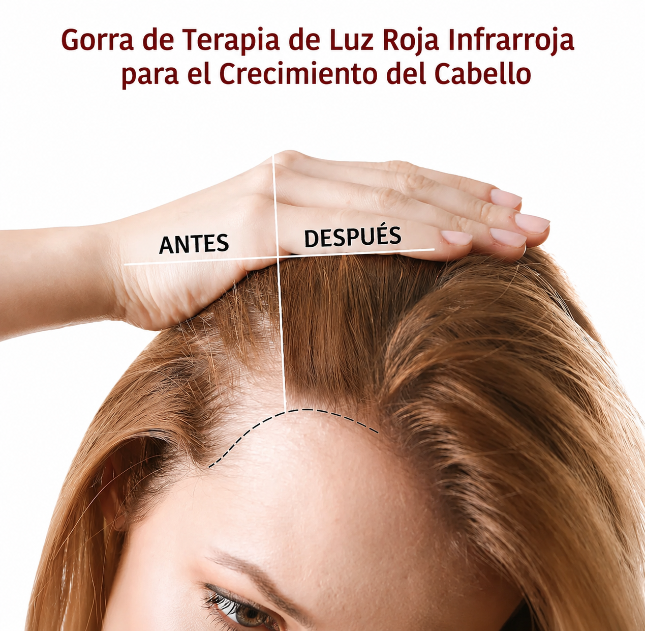 Gorro de terapia de luz roja para un tratamiento capilar saludable
