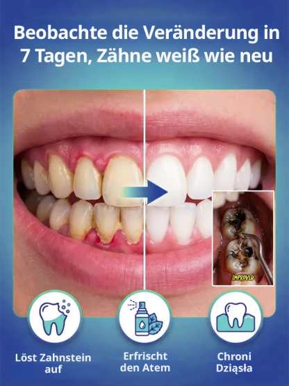 【💯 Zahnschmerzen stoppen in 3 Sek.! 💯】LMU-Notfallspray 🦷 10-fache Geld-zurück-Garantie! 💸 Sofortige Hilfe bei akuter Pulpitis.