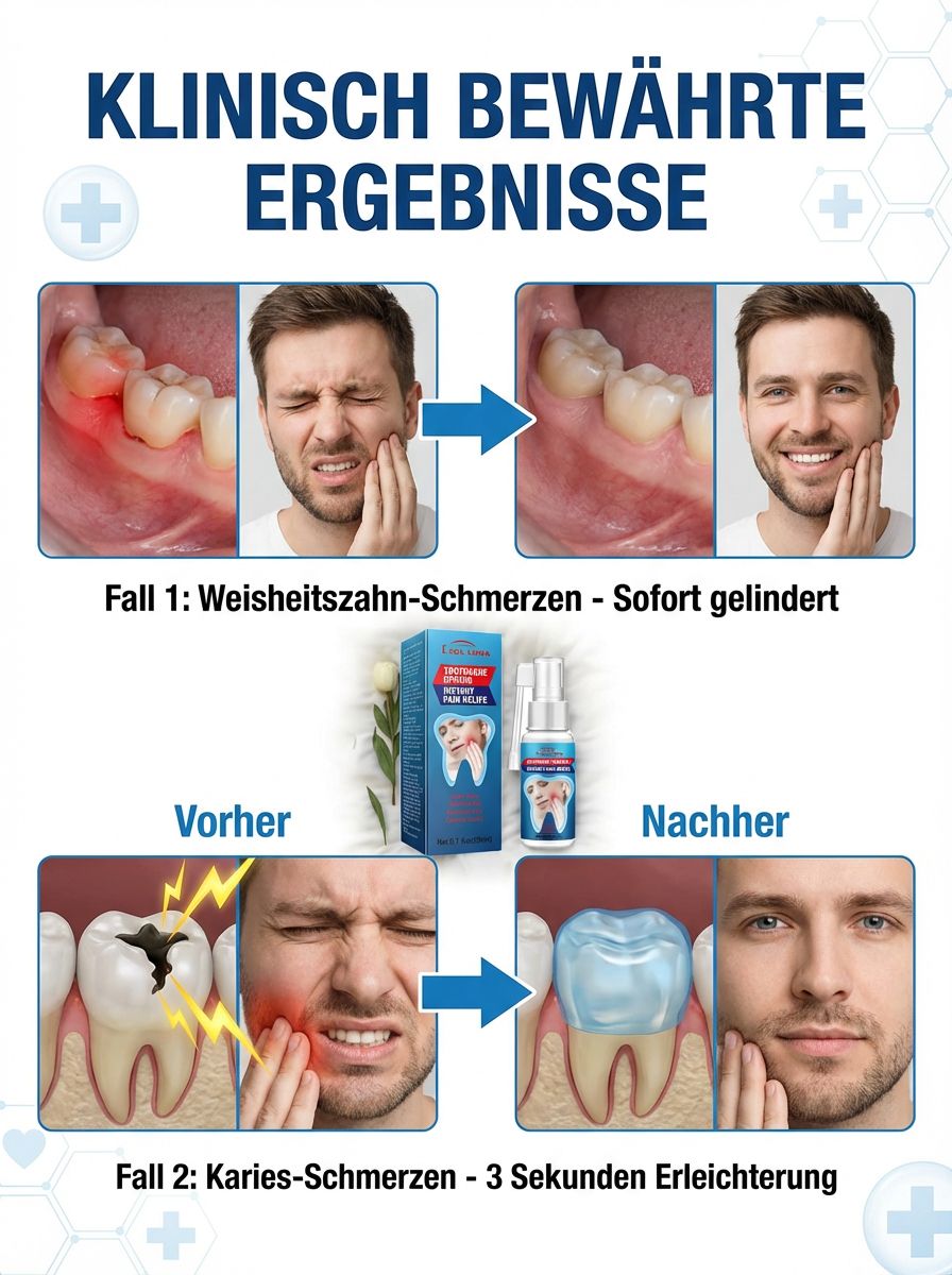 【💯 Zahnschmerzen stoppen in 3 Sek.! 💯】LMU-Notfallspray 🦷 10-fache Geld-zurück-Garantie! 💸 Sofortige Hilfe bei akuter Pulpitis.