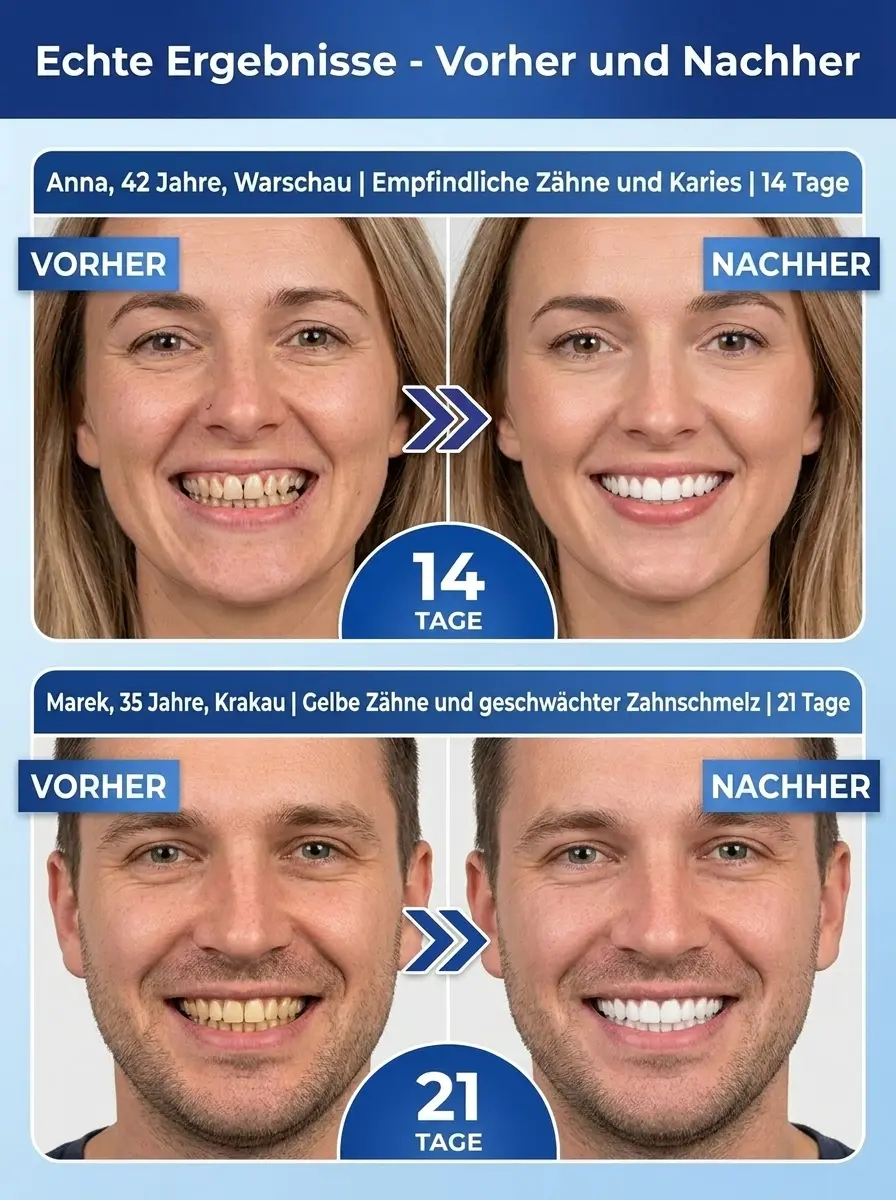 【🦷 Zahnrettung in 60 Sek. 🦷】Smarte Dental-Stripes: Heilt Zahnfleisch & festigt Zähne! ✨