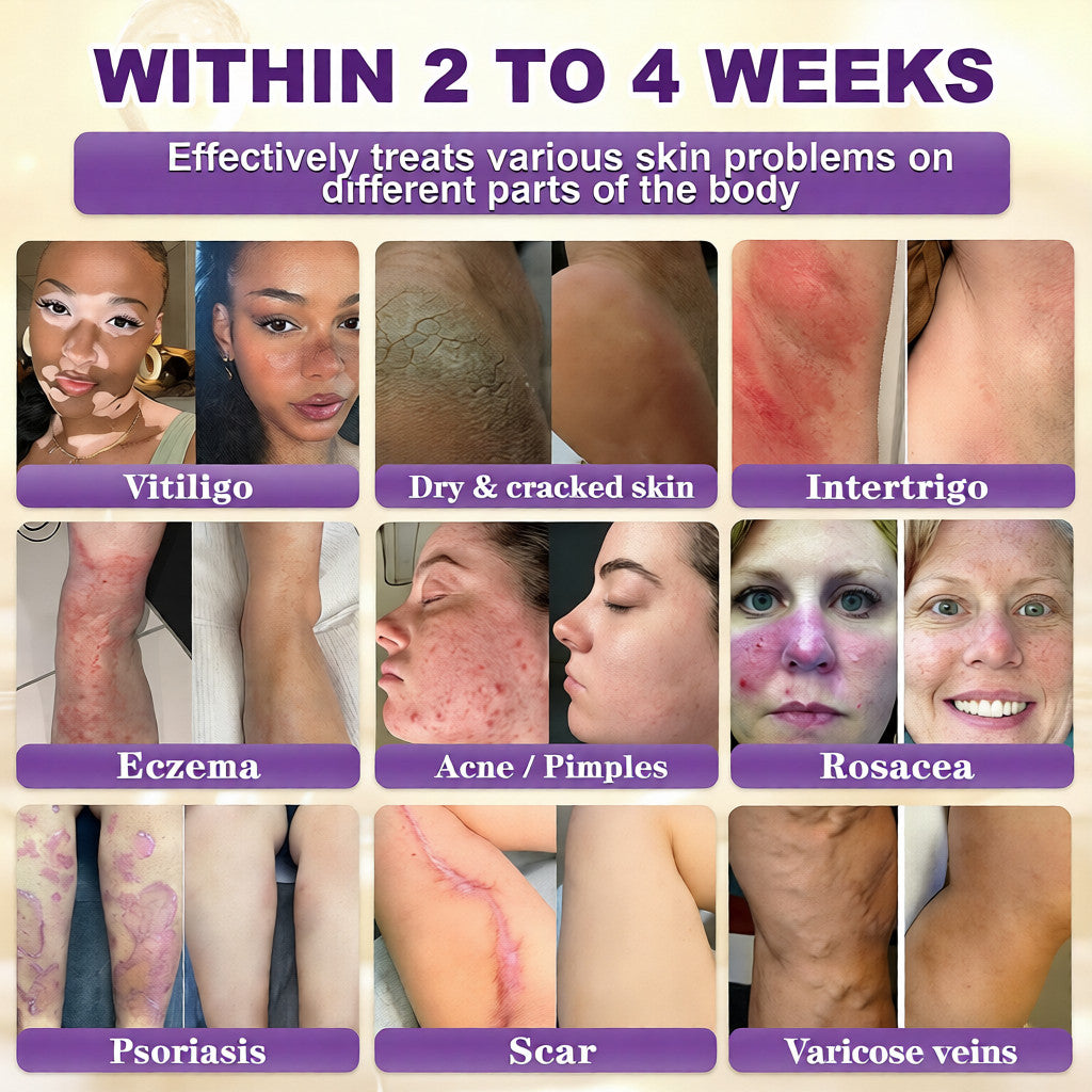 Made and Shipped from USA ✨QIAWI® Biotin 10-in-1 Skin Restoration Cream 🍀