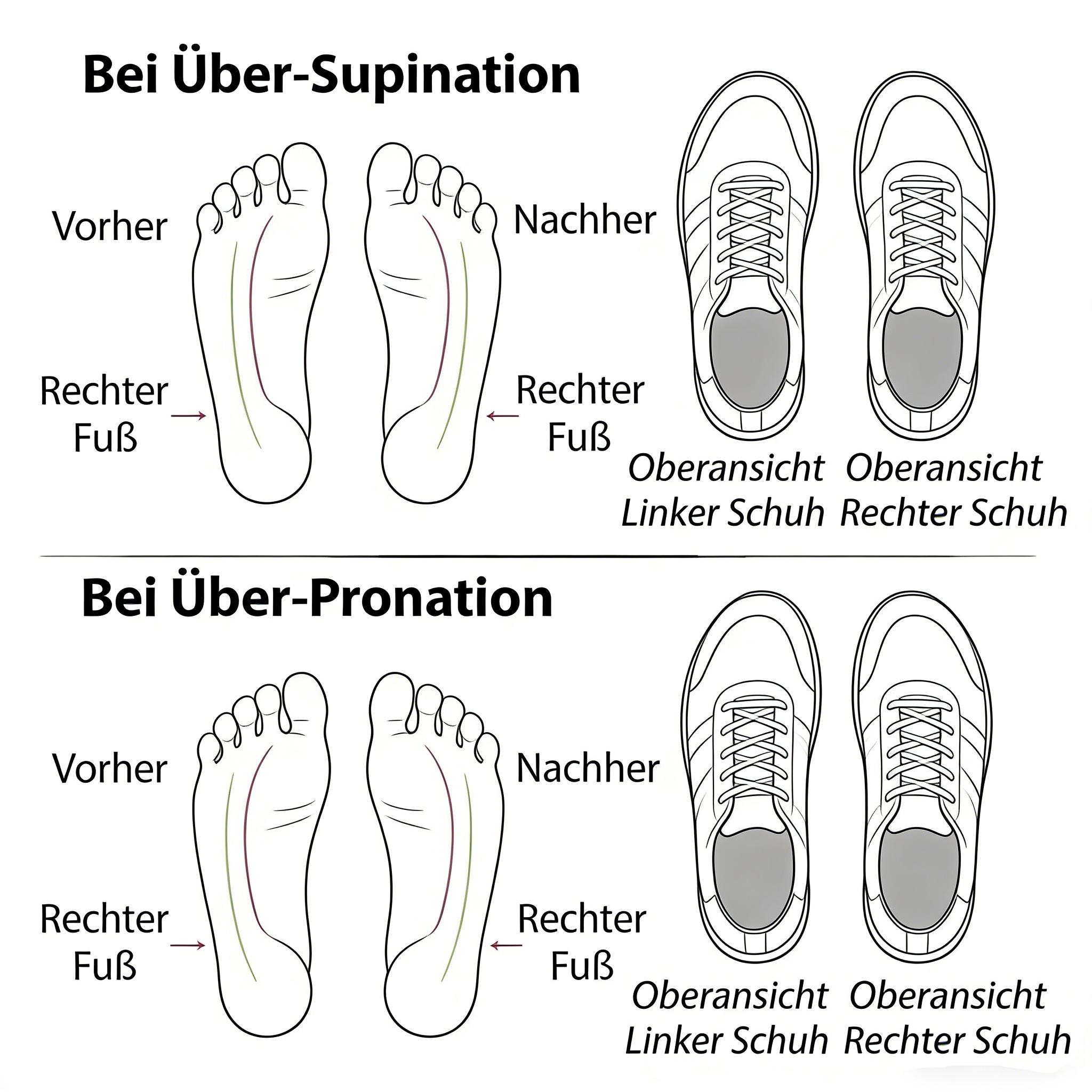 AZZY Premium Orthopedic Lace-Up Ankle Boots, Genuine Comfy Orthopedic Leather Boots, 2020 Design