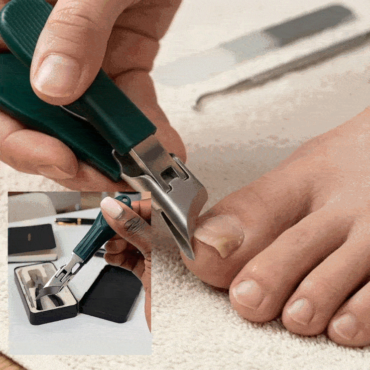 ✂️✨ Sada klieští na nechty Eagle Beak so širokou čeľusťou | 25° skosená čepeľ proti štiepeniu, ideálna na hrubé a zarastené nechty na nohách | Ultra ostrý nástroj na manikúru a pedikúru z nehrdzavejúcej ocele 🦅
