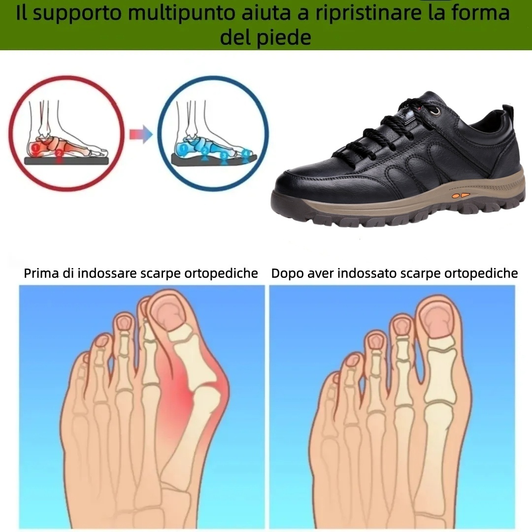 【⏰Offerta a tempo limitato: 70% di sconto - Non lasciartela sfuggire!】Scarpe ortopediche ergonomiche - ✅️Correggono la postura durante la camminata e alleviano il dolore ai piedi - Nuova versione impermeabile e antiscivolo 👞Pelle bovina australiana selez