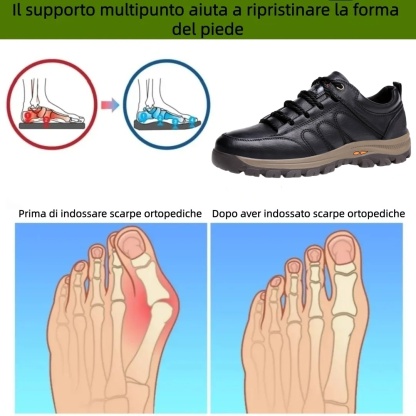 【⏰Offerta a tempo limitato: 70% di sconto - Non lasciartela sfuggire!】Scarpe ortopediche ergonomiche - ✅️Correggono la postura durante la camminata e alleviano il dolore ai piedi - Nuova versione impermeabile e antiscivolo 👞Pelle bovina australiana selez