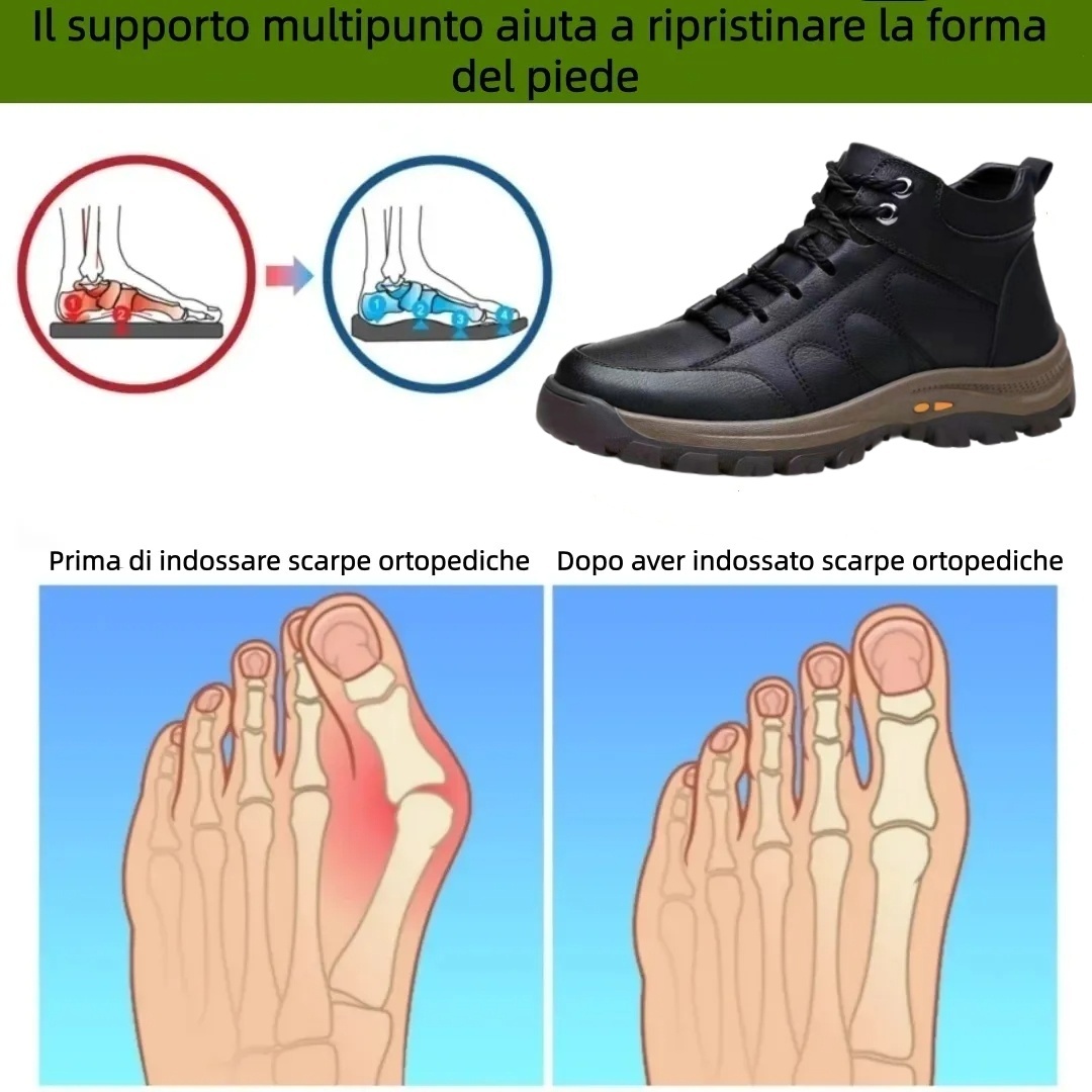 【⏰Offerta a tempo limitato: 70% di sconto - Non lasciartela sfuggire!】Scarpe ortopediche ergonomiche - ✅️Correggono la postura durante la camminata e alleviano il dolore ai piedi - Nuova versione impermeabile e antiscivolo 👞Pelle bovina australiana selez