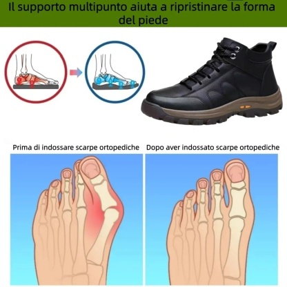 【⏰Offerta a tempo limitato: 70% di sconto - Non lasciartela sfuggire!】Scarpe ortopediche ergonomiche - ✅️Correggono la postura durante la camminata e alleviano il dolore ai piedi - Nuova versione impermeabile e antiscivolo 👞Pelle bovina australiana selez