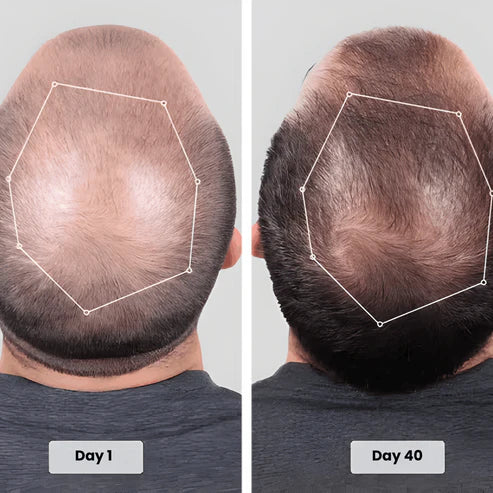 Infrared Light Hair Growth and Care Cap