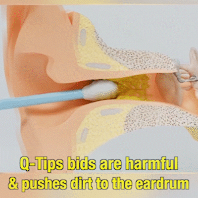 Professional earwax removal kit demo