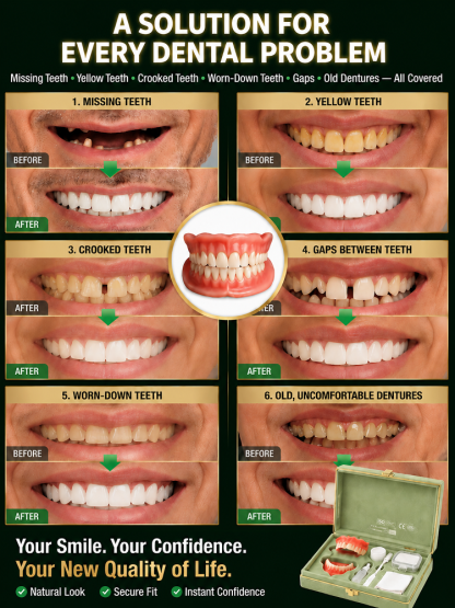 ✨ Instant Perfect Smile! Custom-Fit Cosmetic Veneers 🦷