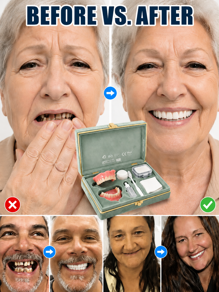 ✨ Instant Perfect Smile! Custom-Fit Cosmetic Veneers 🦷