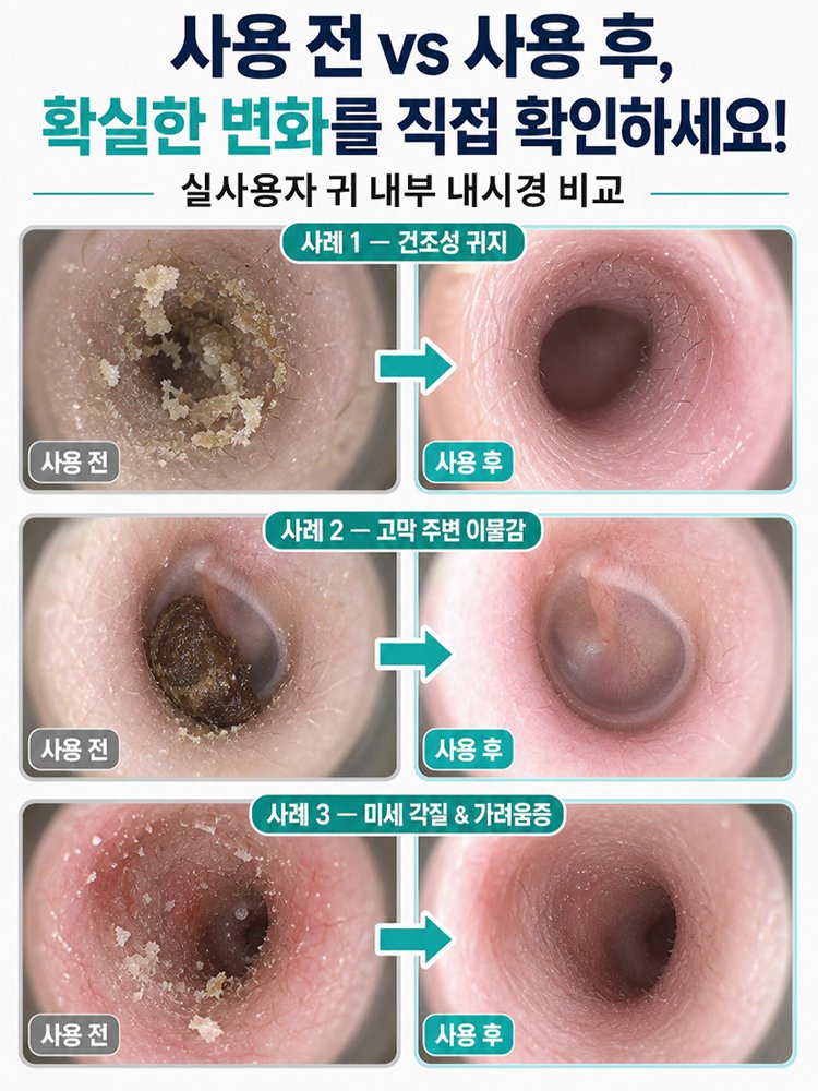 귀 청소 케어 점착식 귀이개