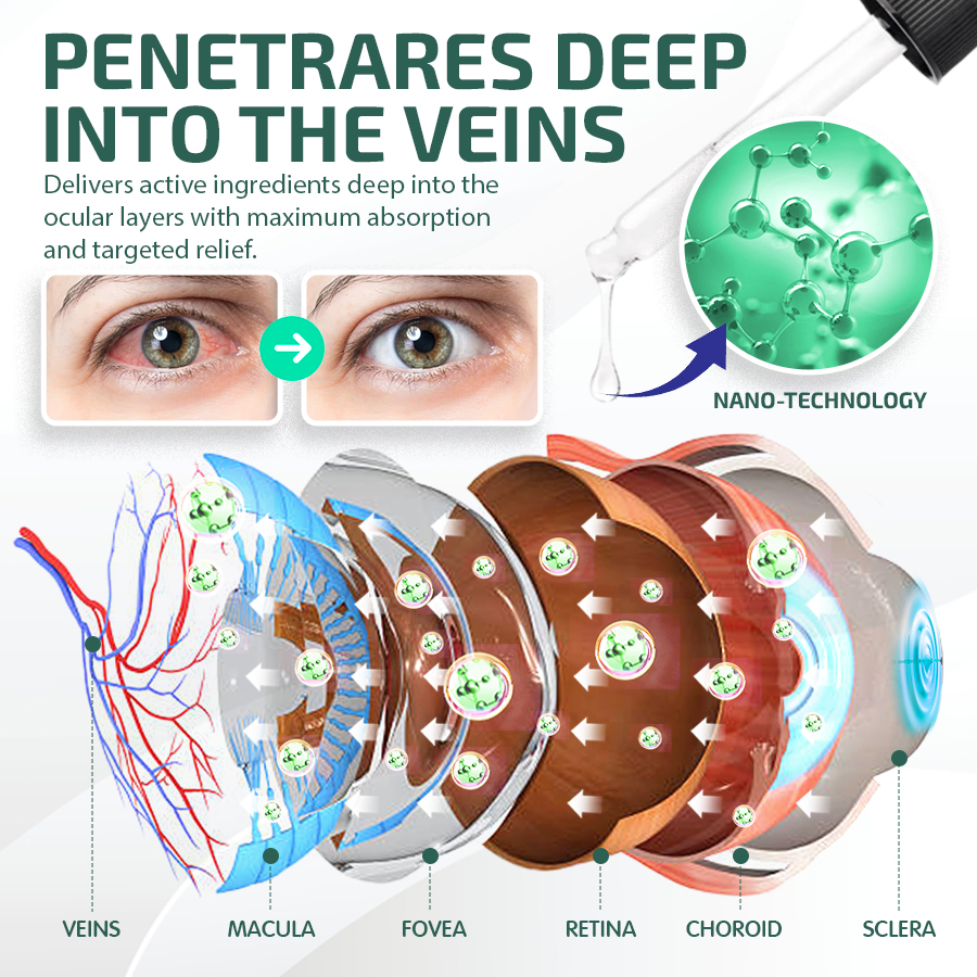 NEGUSY™ Nano Očné Kvapky Sérum 👩‍⚕️ Odporúčané Kráľovskou kolegiou oftalmológov (Vhodné pre presbyopiu, syndróm suchého oka, glaukóm a kataraktu)