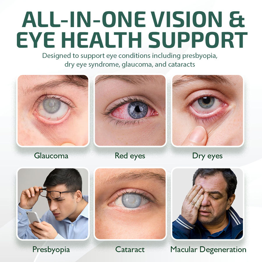 NEGUSY™ Nano Očné Kvapky Sérum 👩‍⚕️ Odporúčané Kráľovskou kolegiou oftalmológov (Vhodné pre presbyopiu, syndróm suchého oka, glaukóm a kataraktu)