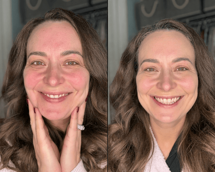 Foundation before and after result 3