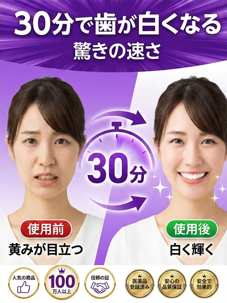 ホワイトニングステイン除去パープル歯貼り