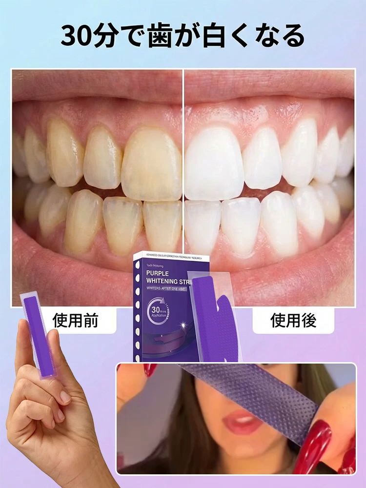 ホワイトニングステイン除去パープル歯貼り