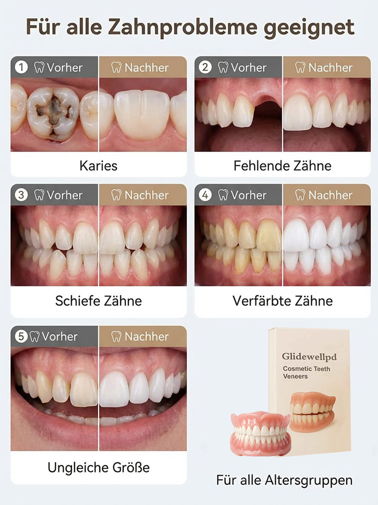 【✨ Präzisions-Prothese ✨】Neues Lächeln in nur 3 Minuten: Absolut unsichtbar! 😁